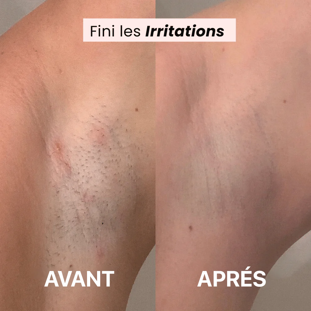 Meloria® – Rasoir Douceur pour une Peau Lisse Sans Effort