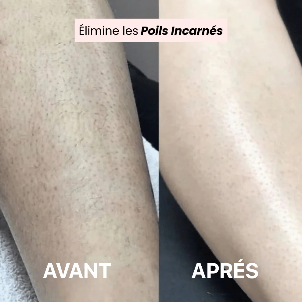 Meloria® – Rasoir Douceur pour une Peau Lisse Sans Effort