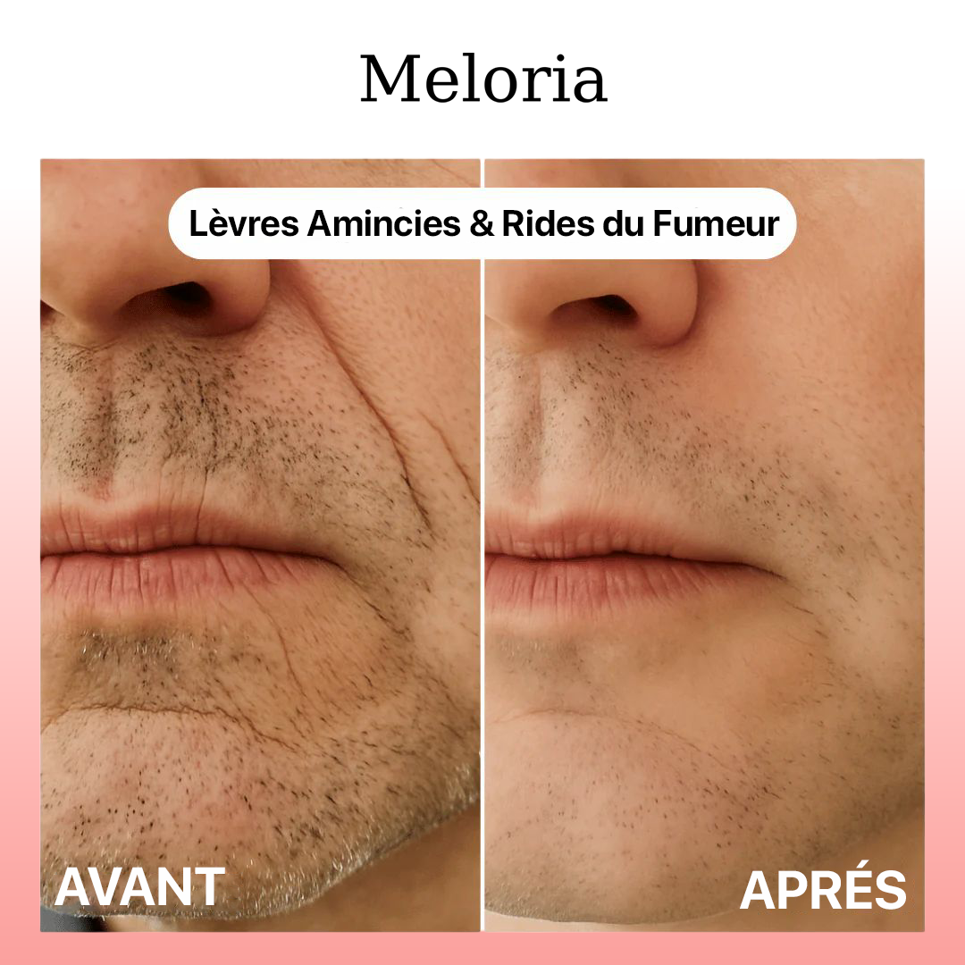 Meloria® – Sérum Peptide collagène