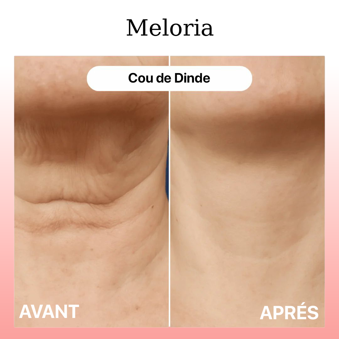 Meloria® – Sérum Peptide collagène