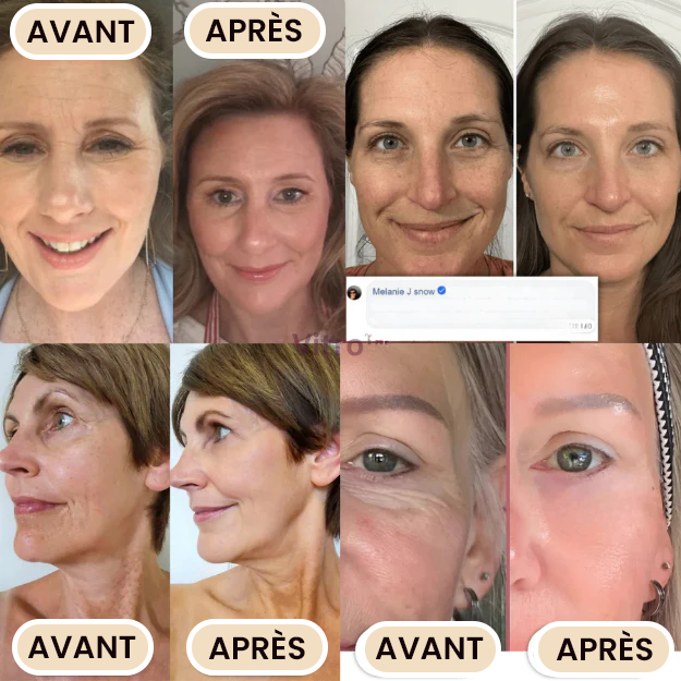 Meloria Baume au Calcium Repulpant